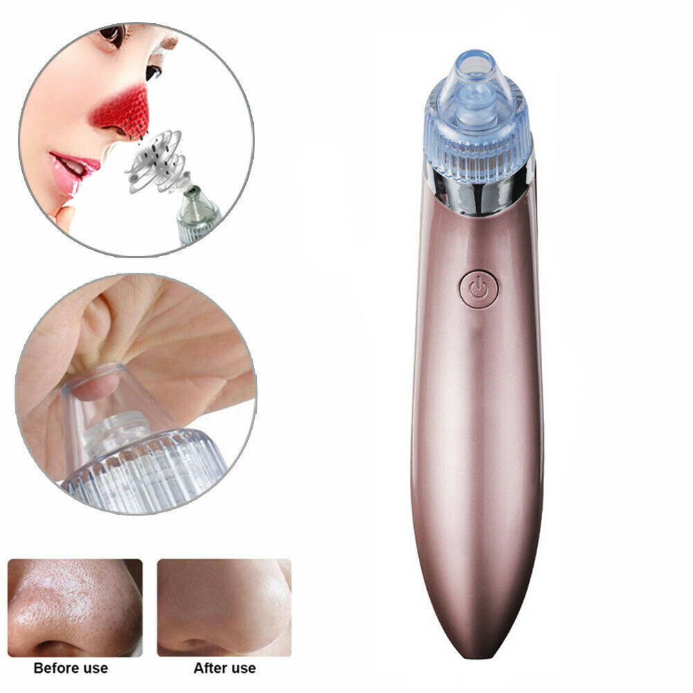 Electric Blackhead Vacuum Pore Cleaner Acne Pimple