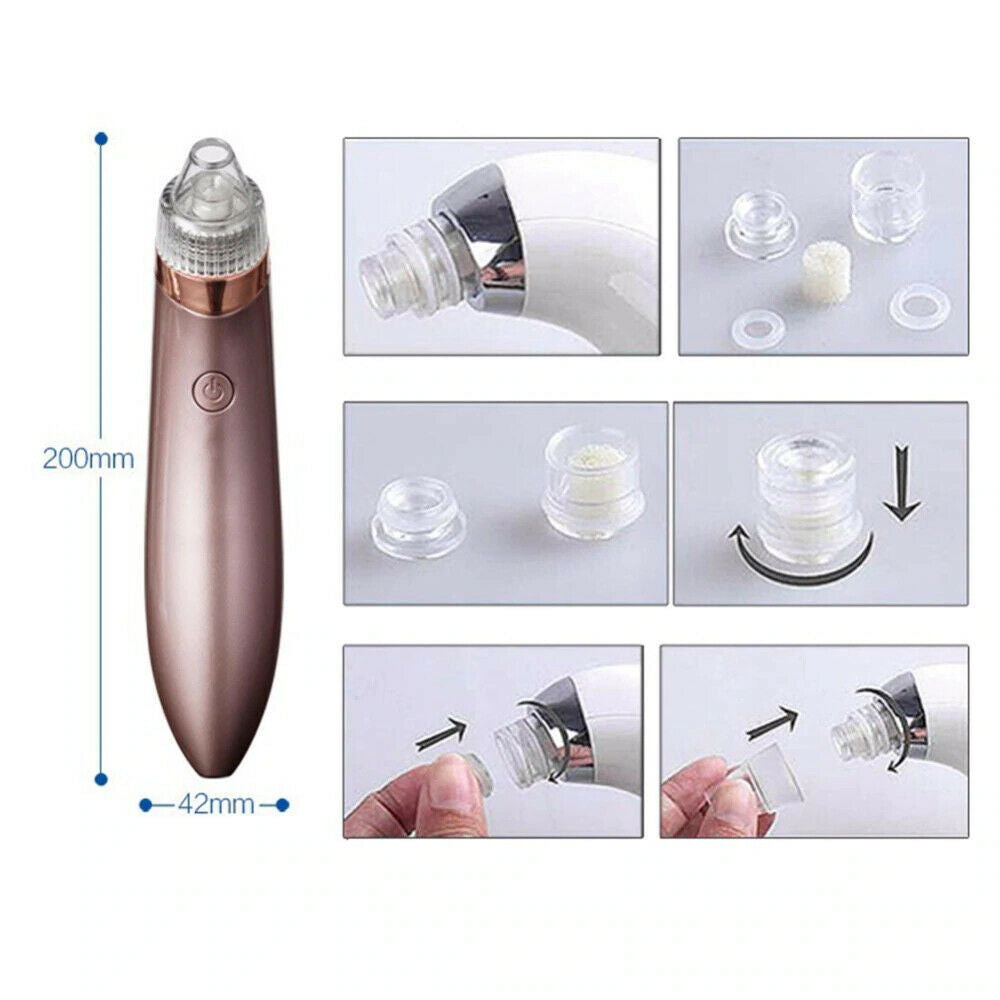 Electric Blackhead Vacuum Pore Cleaner Acne Pimple